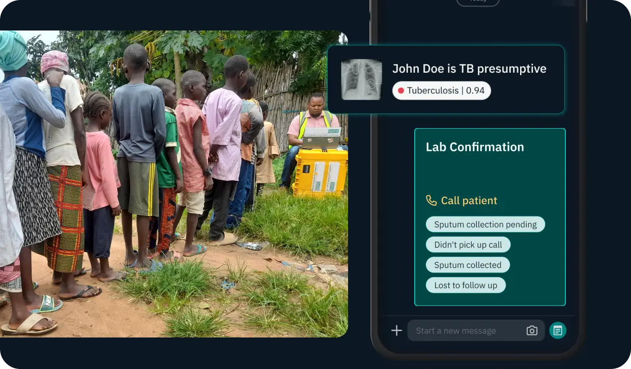 Comprehensive TB Detection & Management: For Adult and Pediatric TB