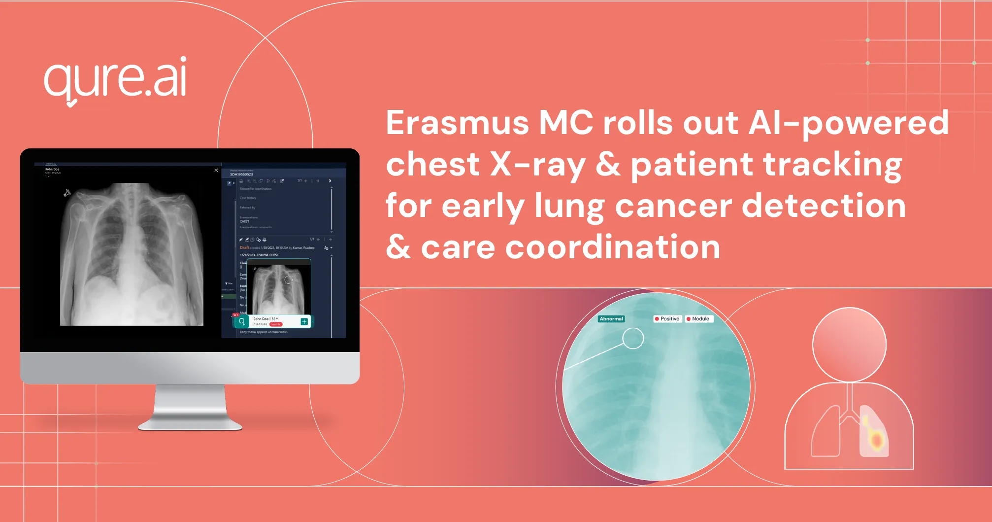 Erasmus MC rolls out_Erasmus MC roll outs (1).webp