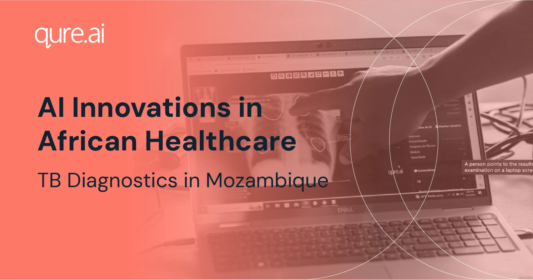 Innovation in african healthcare-01.webp