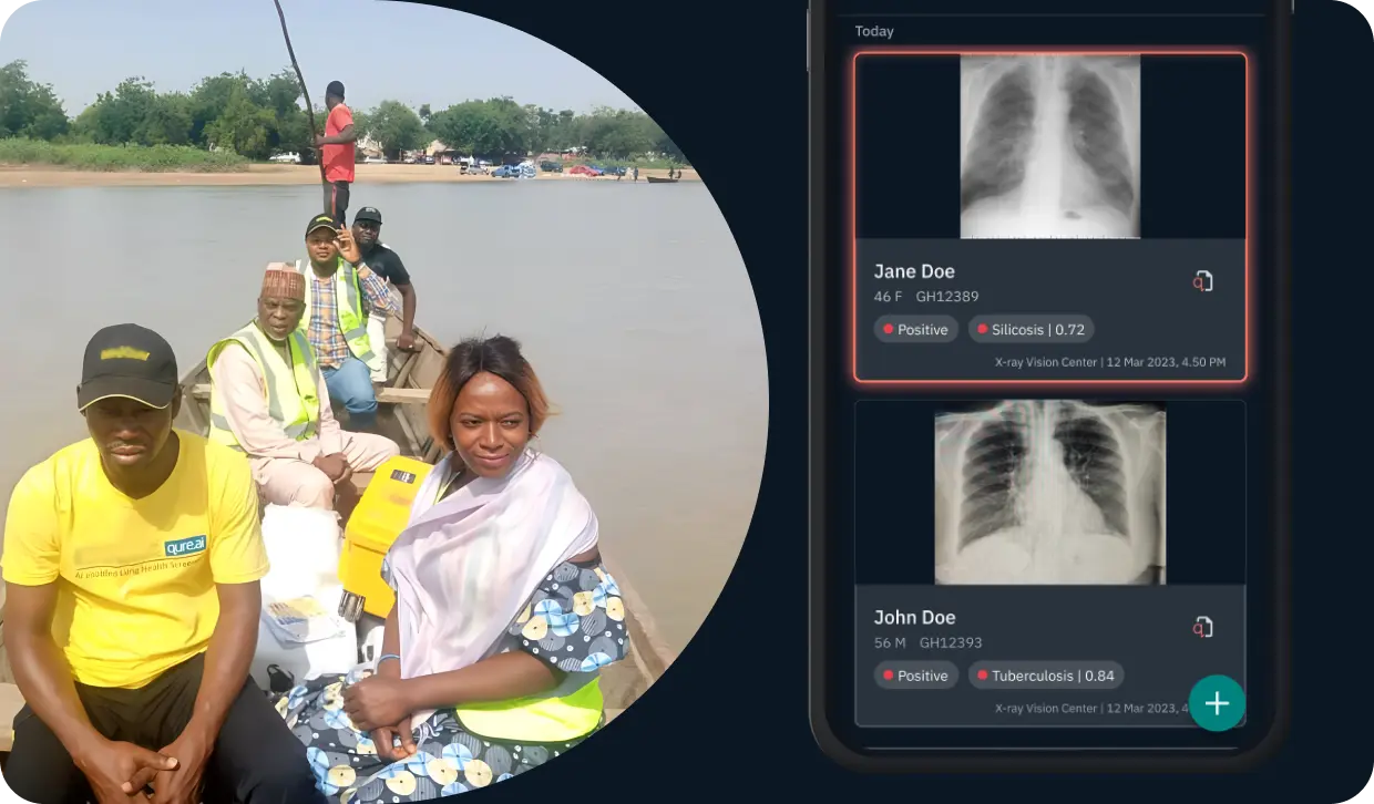 Silicosis (Pneumoconiosis) Diagnosis and Treatment
